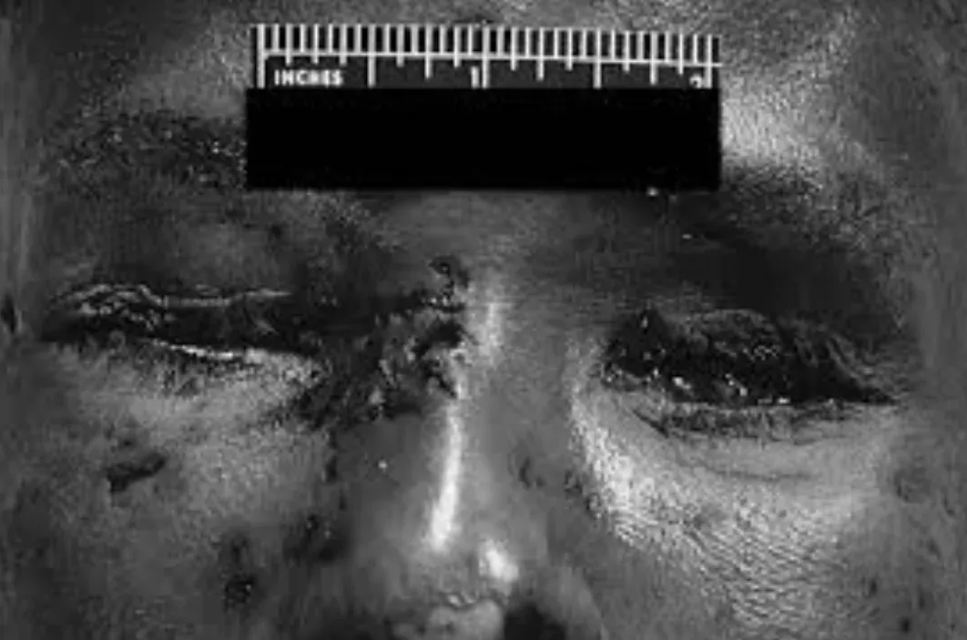 Las víctimas del Asesino del Globo Ocular